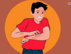 Kenali, Berikut Lima Ciri Khas Gatal Akibat Diabetes